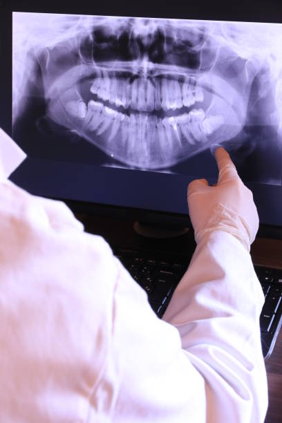 Best Pediatric Emergency Dentist in Clarksburg, MD